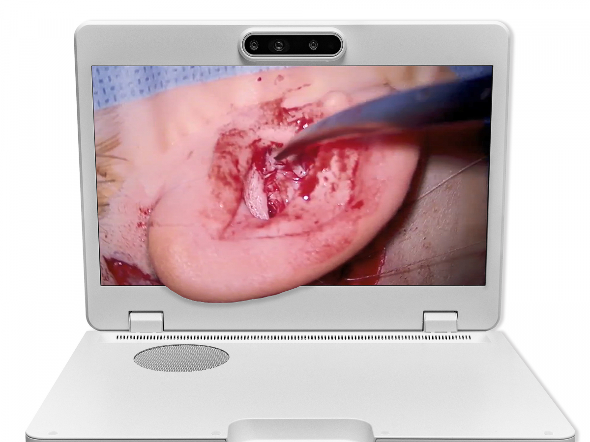 达擎之＂Heads-up 3D显微手术显示系统＂，整合4K裸眼3D显示及眼球追踪系统，具备快速追踪人眼移动位置功能，减轻医师长时间维持固定姿势的负担，让医师能有更宽广清晰的3D立体视野及更舒适的姿势来执行手术。